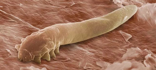 Какие бывают кожные паразиты у человека