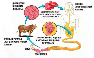 Бычий цепень: как лечат
