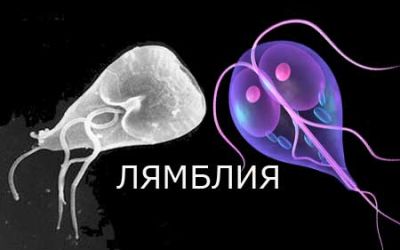 Лямблиоз: что это такое и как его лечат