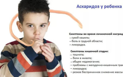 Что нужно знать об аскаридах у детей