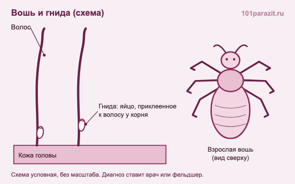 Схема: вошь и гнида